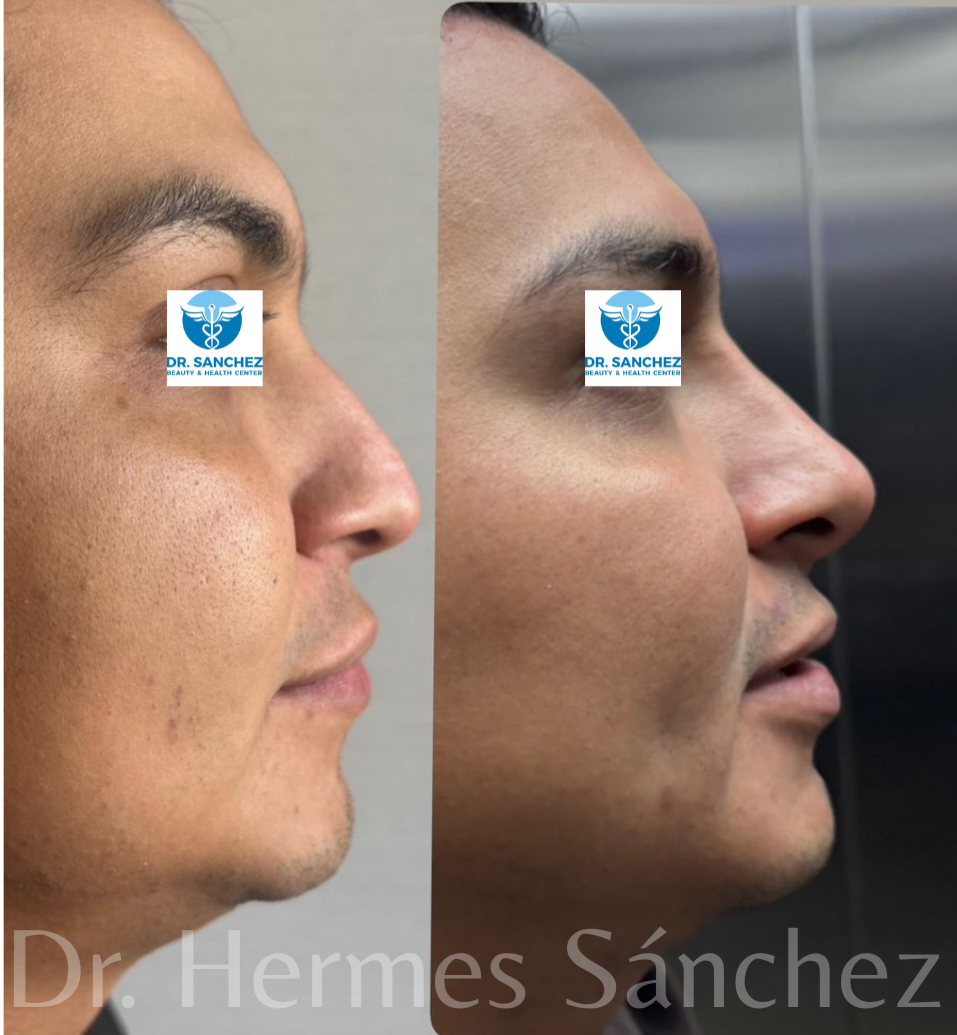 Galería - Transformación 10